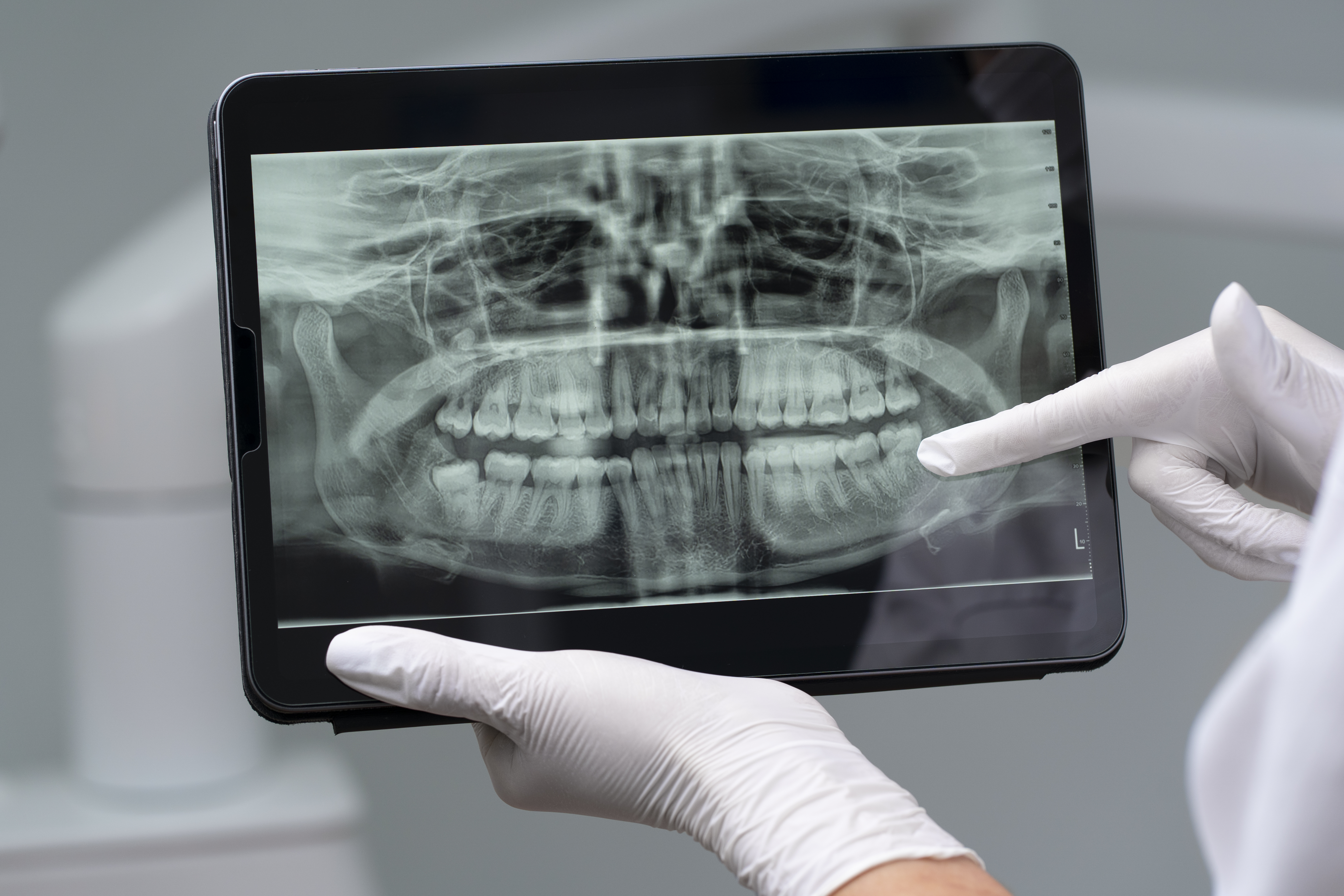 Cómo la radiología digital está transformando la odontología